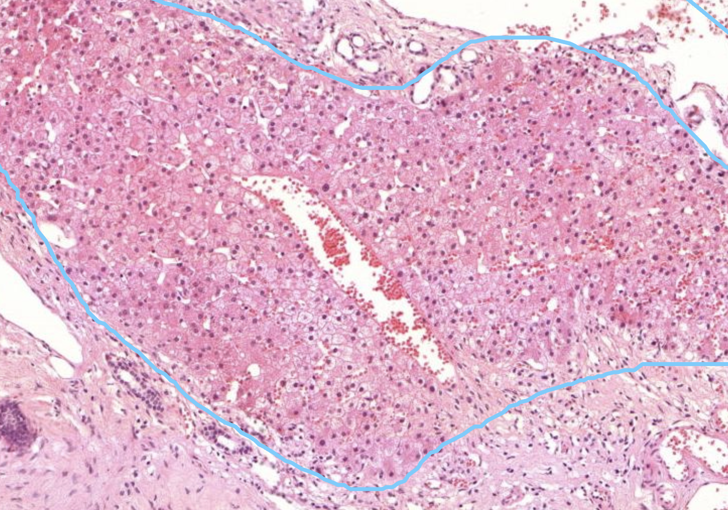 Histopathologisches Bild: Kolonschleimhaut